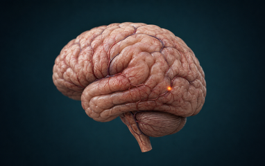 brain 382x240